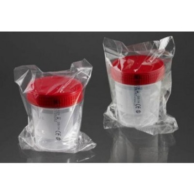 Sterilna posuda za urin 120ml